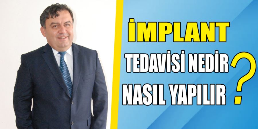 İMPLANT TEDAVİSİ NEDİR, NASIL YAPILIR?