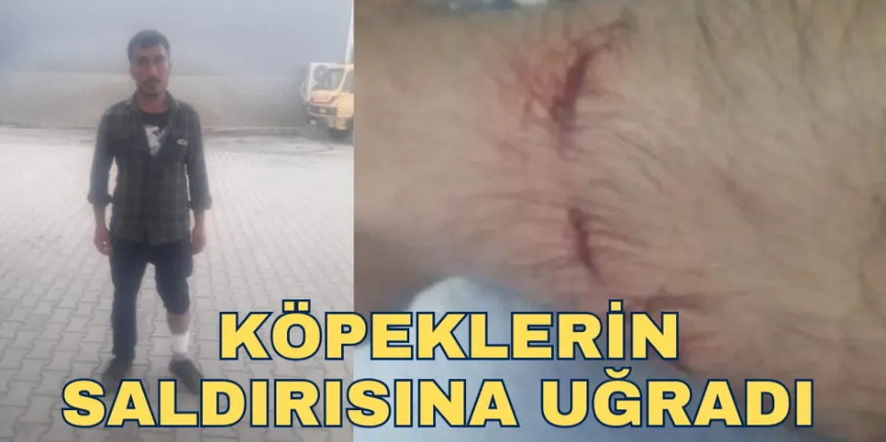 KÖPEKLERİN SALDIRISINA UĞRADI