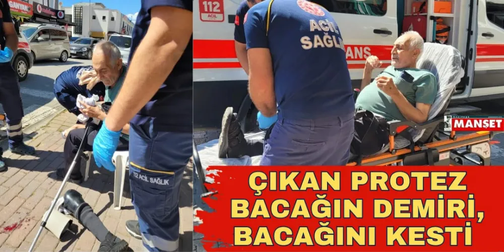 ÇIKAN PROTEZ BACAĞIN DEMİRİ, BACAĞINI KESTİ