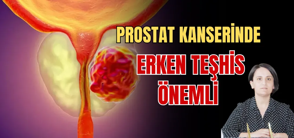 PROSTAT KANSERİNDE ERKEN TEŞHİS ÖNEMLİ 