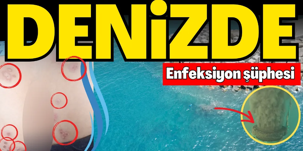 DENİZDE ENFEKSİYON ŞÜPHESİ
